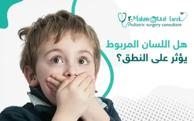 هل اللسان المربوط يؤثر على النطق؟ 
