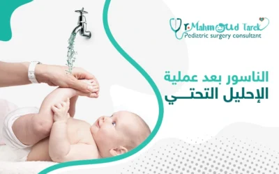 ما أسباب ظهور الناسور بعد عملية الإحليل التحتي؟ وكيف يُعالج؟