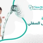 عملية الإحليل السفلي