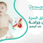 علاج فتق السرة بدون جراحة عند الرضع