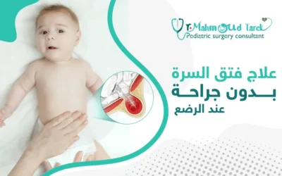 هل يُمكن علاج فتق السرة بدون جراحة عند الرضع​؟