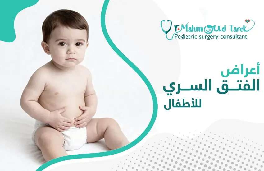 اعراض-الفتق-السري-للاطفال أعراض الفتق السري للأطفال