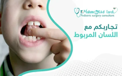 تجاربكم مع اللسان المربوط