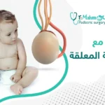 تجربتي مع الخصية المعلقة