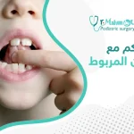 تجاربكم مع اللسان المربوط