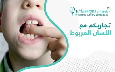 تجاربكم مع اللسان المربوط