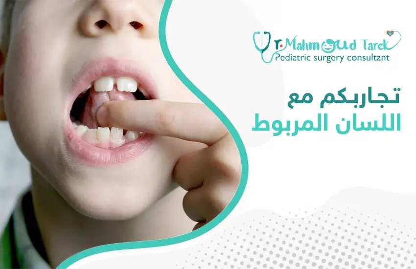 تجاربكم-مع-اللسان-المربوط تجاربكم مع اللسان المربوط