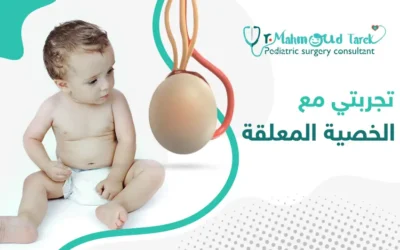 تجربتي مع الخصية المعلقة