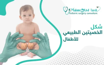 إليك كيفية التعرف إلى شكل الخصيتين الطبيعي للأطفال