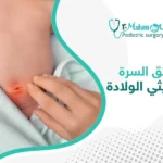 شكل فتق السرة عند حديثي الولادة