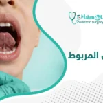 أنواع اللسان المربوط