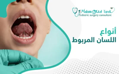أنواع اللسان المربوط: دليل شامل لفهم الحالة وطرق التعامل معها