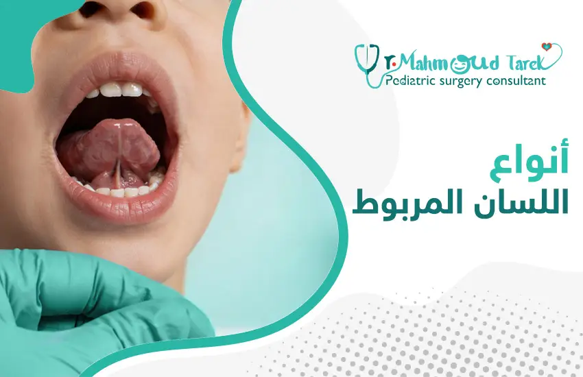 أنواع-اللسان-المربوط أنواع اللسان المربوط